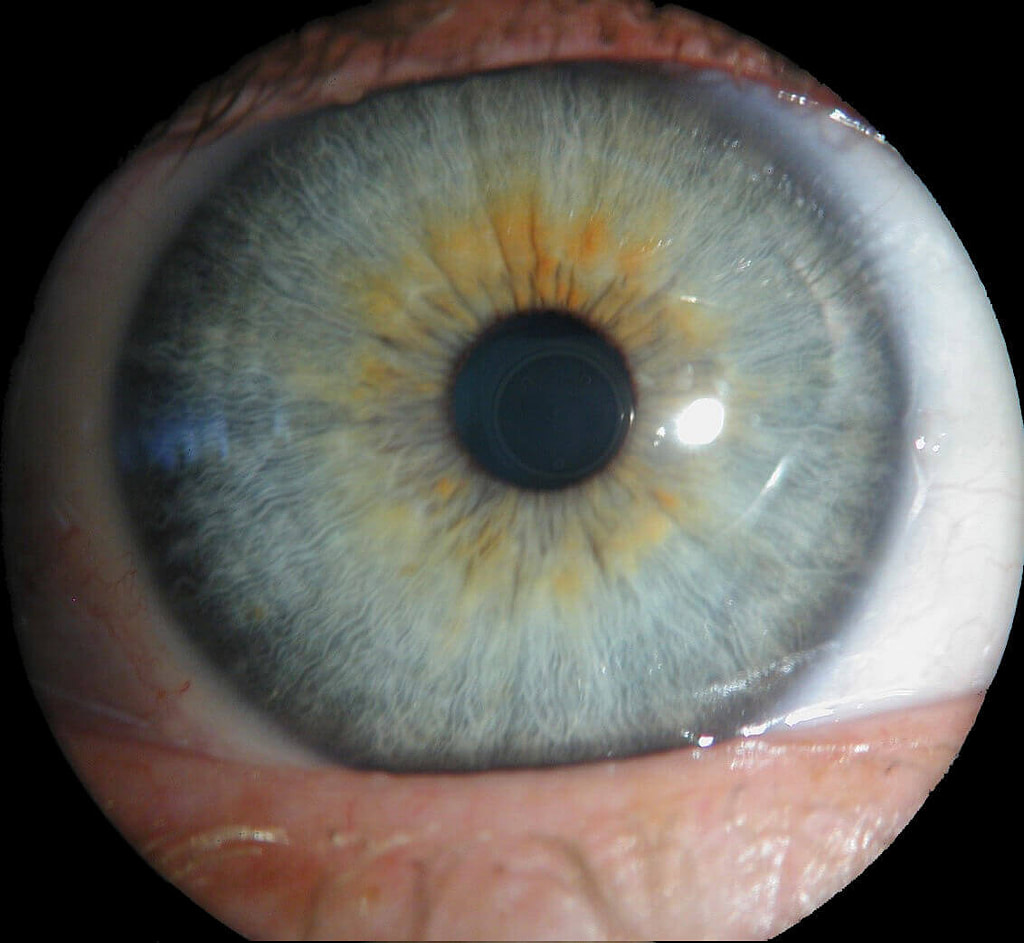 Auge Auge